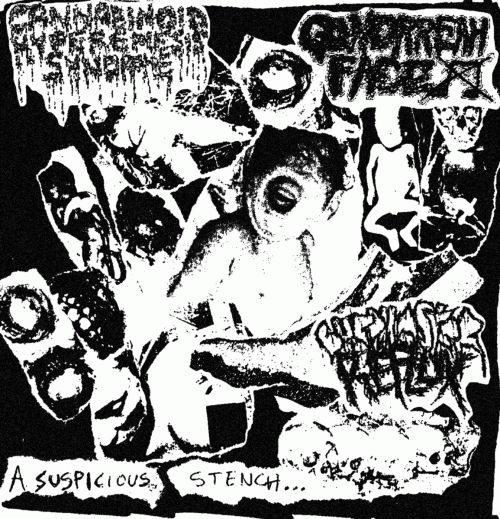 Cannabinoid Hyperemesis Syndrome : A Suspicious Stench